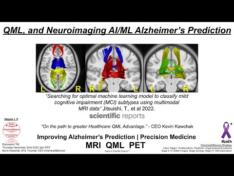 QML, and Neuroimaging AI/ML Alzheimer&#039;s Prediction